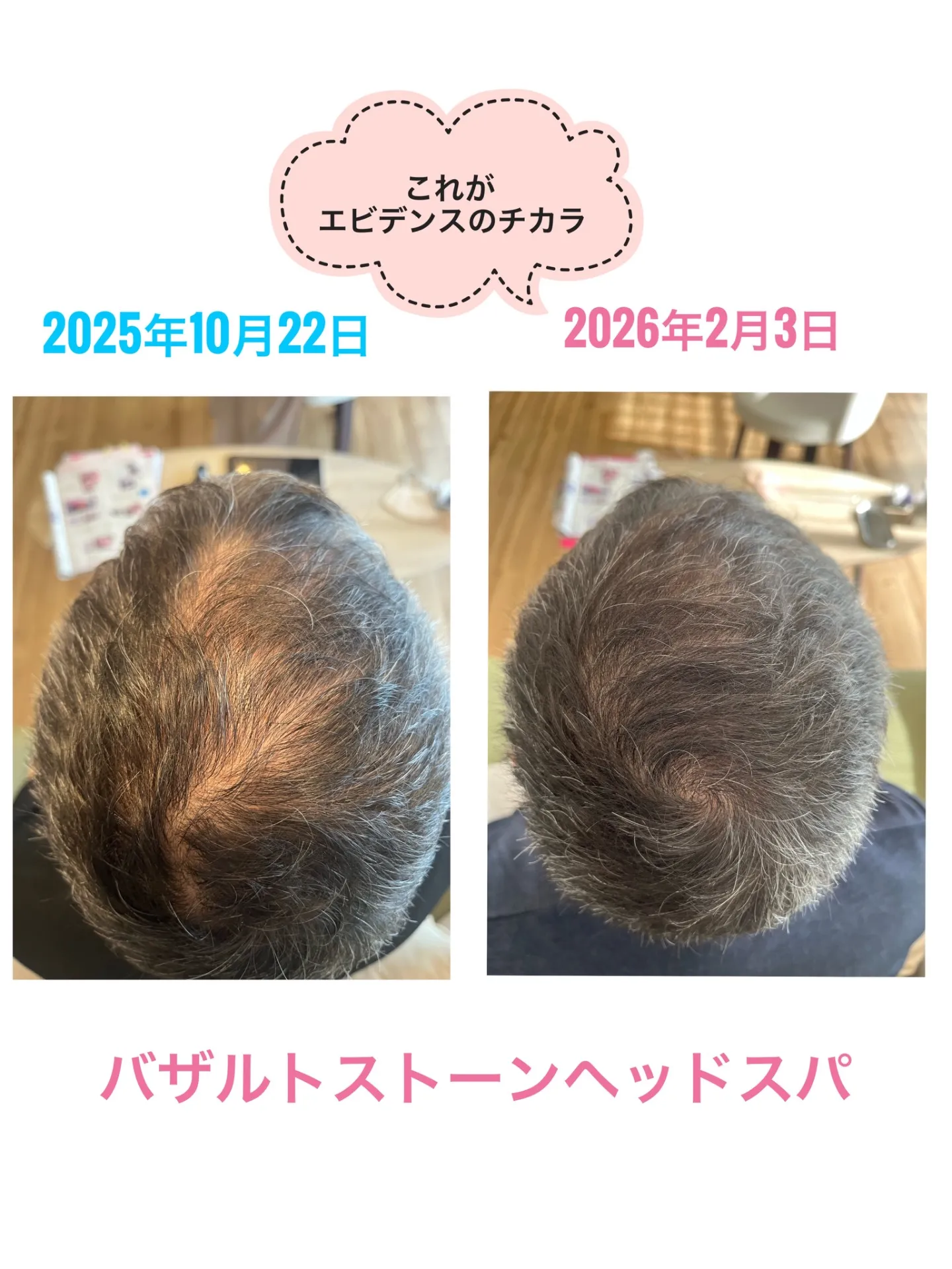 【宇都宮 発毛 エビデンス ヘッドスパ】